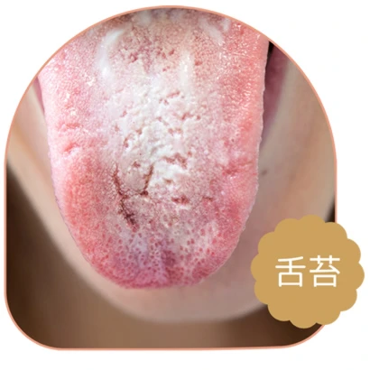 舌苔